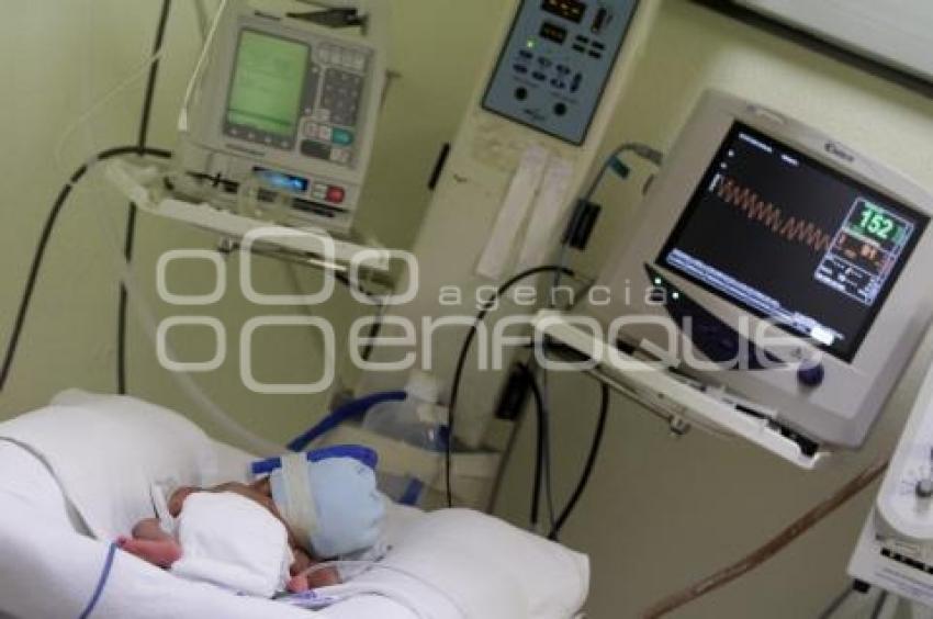NACEN CUATRILLIZOS - HOSPITAL DE LA MUJER