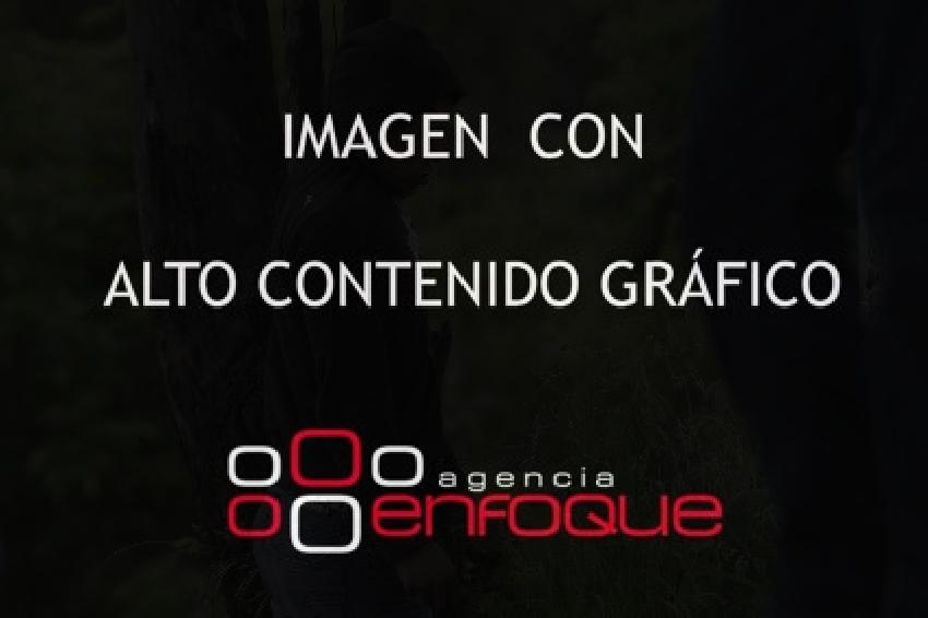 SUICIDIO