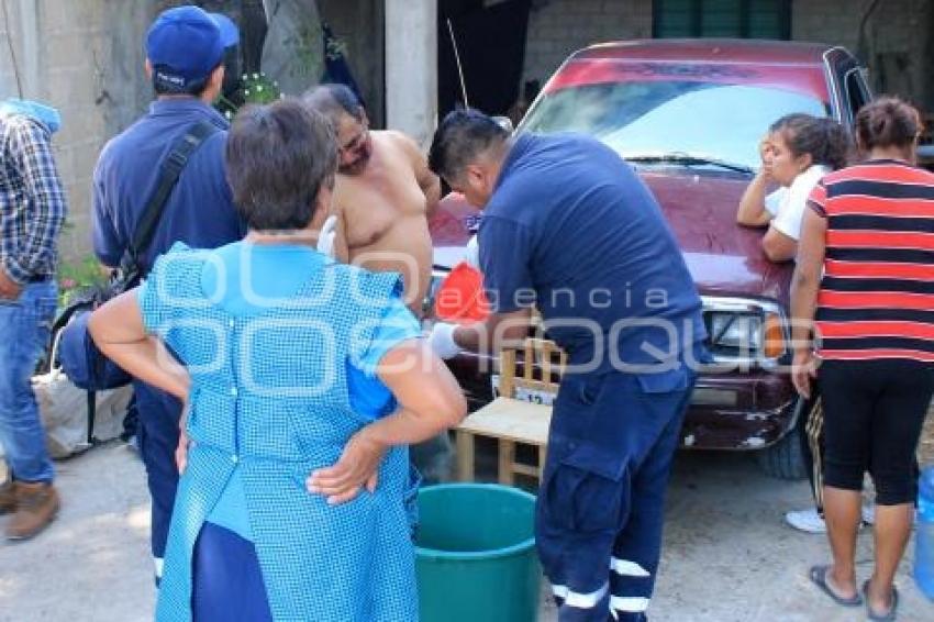 TEHUACÁN . HOMBRE MACHETEADO