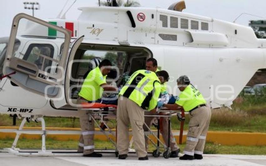 NIÑO QUEMADO TRASLADO AÉREO