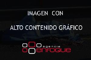 ATROPELLADO EN PISTA