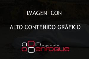 NOTA ROJA . LOMA LINDA