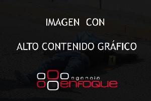 ACCIDENTE MOTOCICLISTA