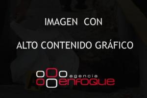 NOTA ROJA . ATROPELLADO