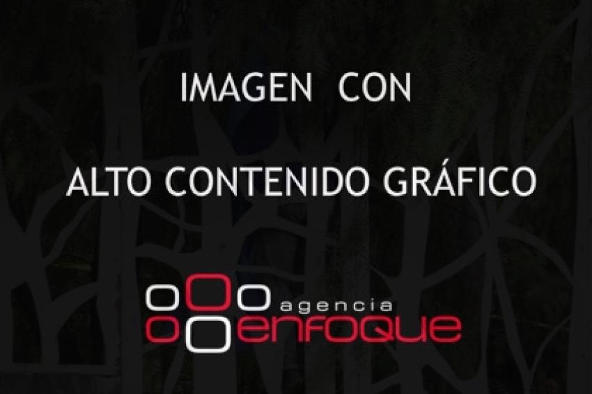 SUICIDIO